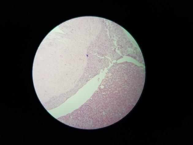 Pituitary Gland Slides - Pituitary Gland 004 100X